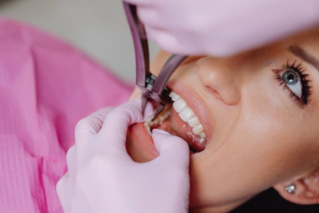 Ból po wszczepieniu implantu zębowego